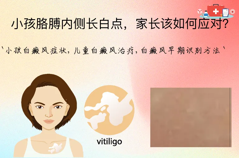 小孩胳膊内侧长白点，家长该如何应对？