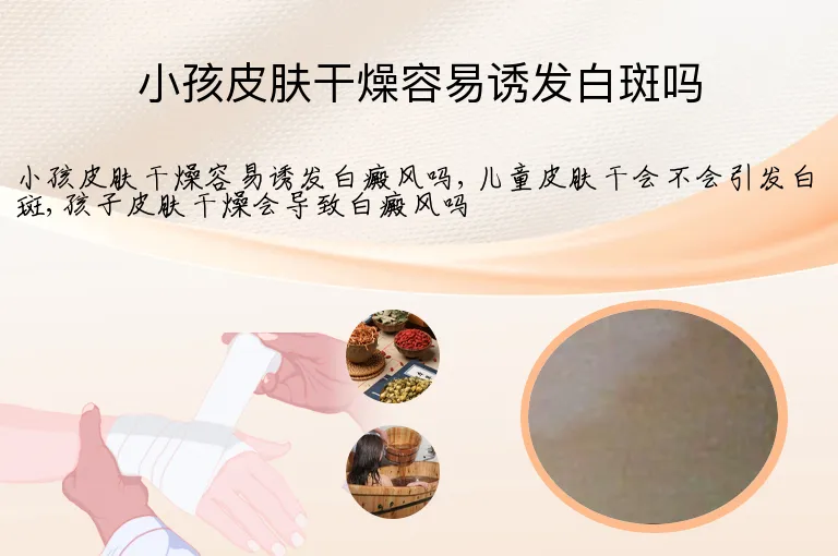 小孩皮肤干燥容易诱发白斑吗