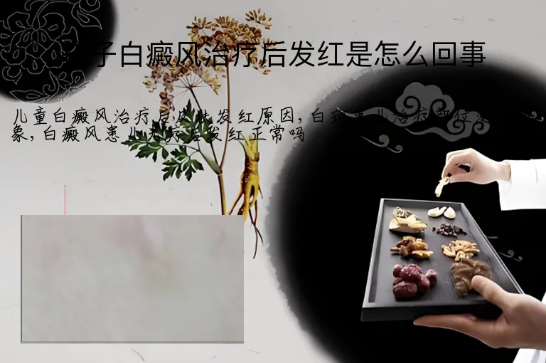 孩子白癜风治疗后发红是怎么回事