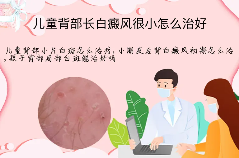儿童背部长白癜风很小怎么治好