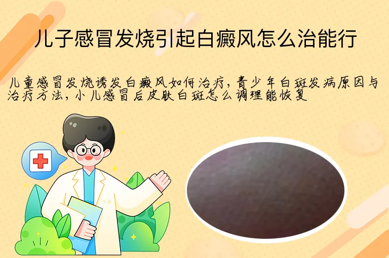 儿子感冒发烧引起白癜风怎么治能行