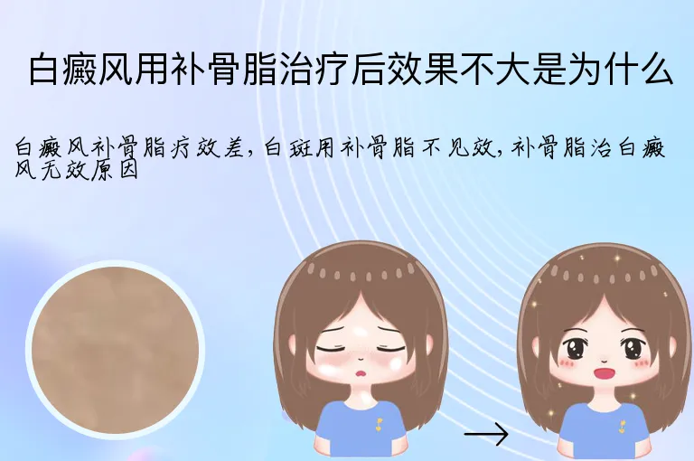 白癜风用补骨脂治疗后效果不大是为什么