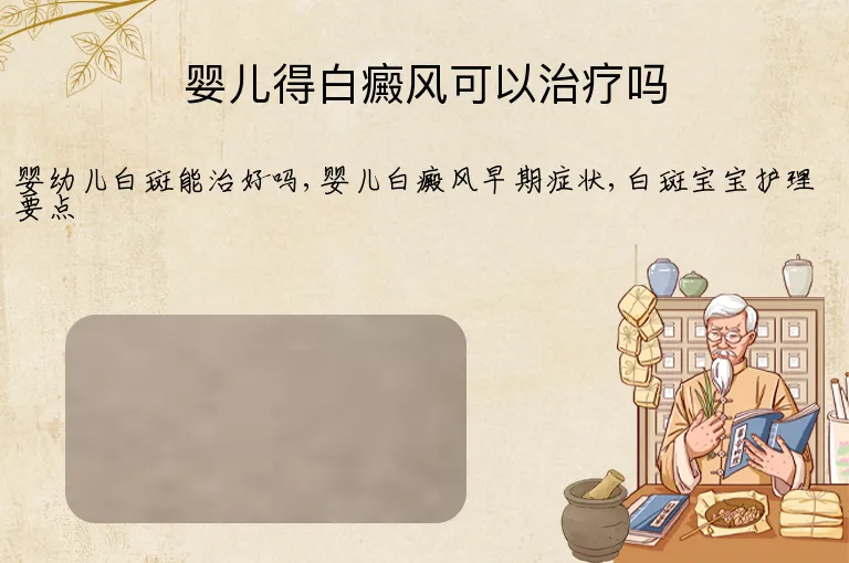 婴儿得白癜风可以治疗吗