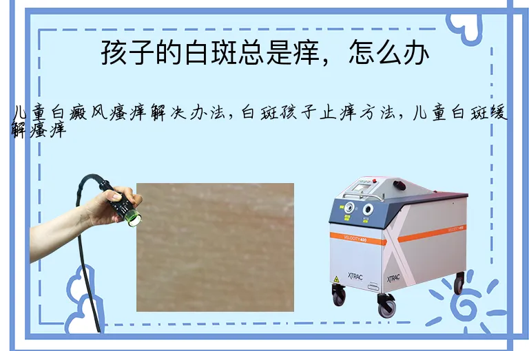 孩子的白斑总是痒，怎么办