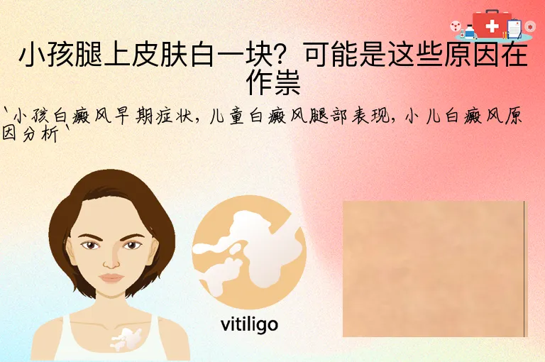小孩腿上皮肤白一块？可能是这些原因在作祟