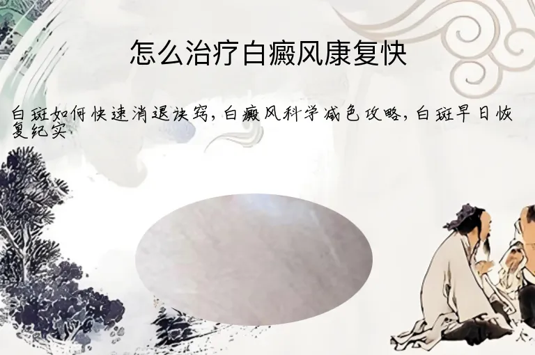 怎么治疗白癜风康复快