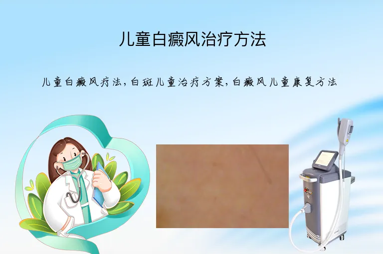 儿童白癜风治疗方法