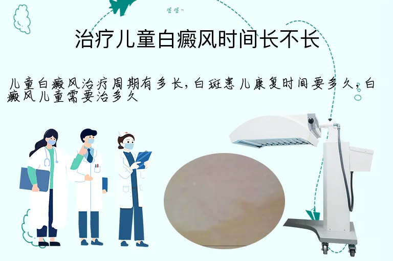 治疗儿童白癜风时间长不长