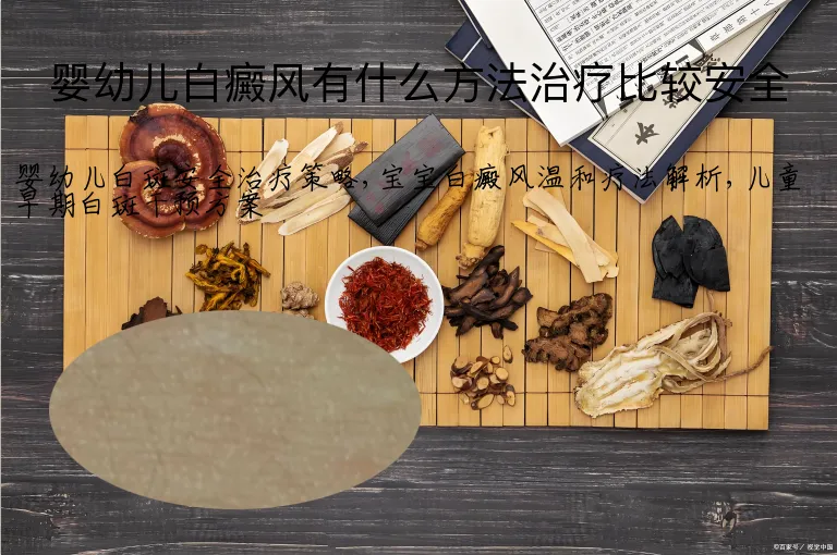 婴幼儿白癜风有什么方法治疗比较安全