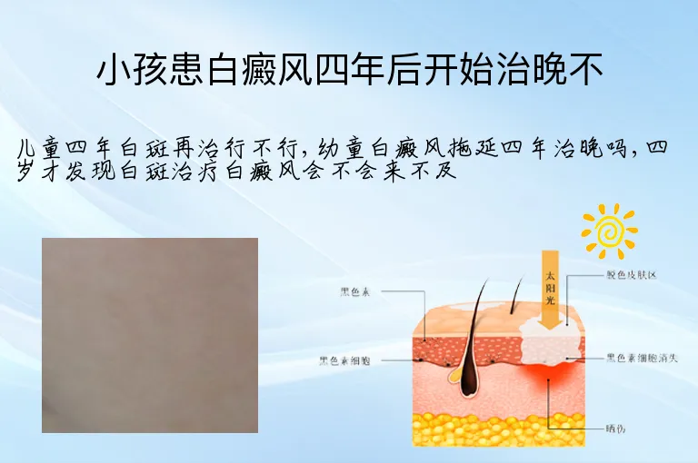 小孩患白癜风四年后开始治晚不