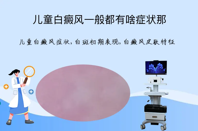 儿童白癜风一般都有啥症状那