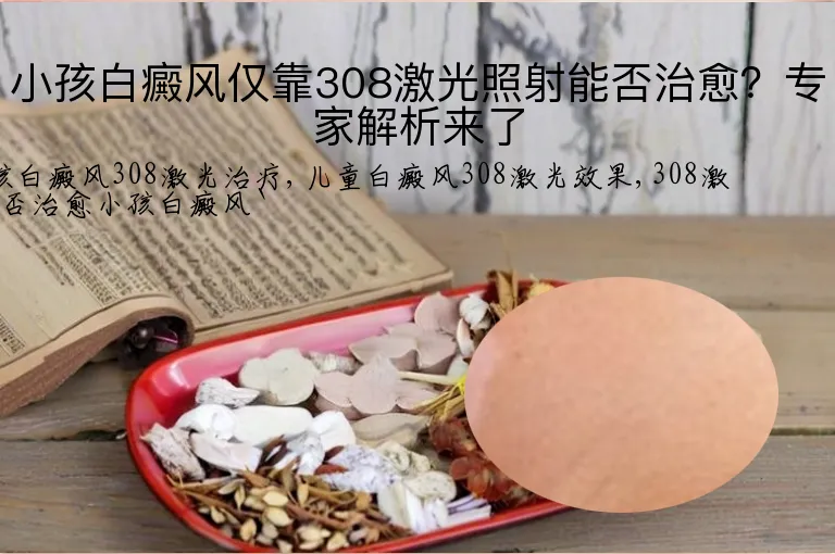 小孩白癜风仅靠308激光照射能否治愈？专家解析来了