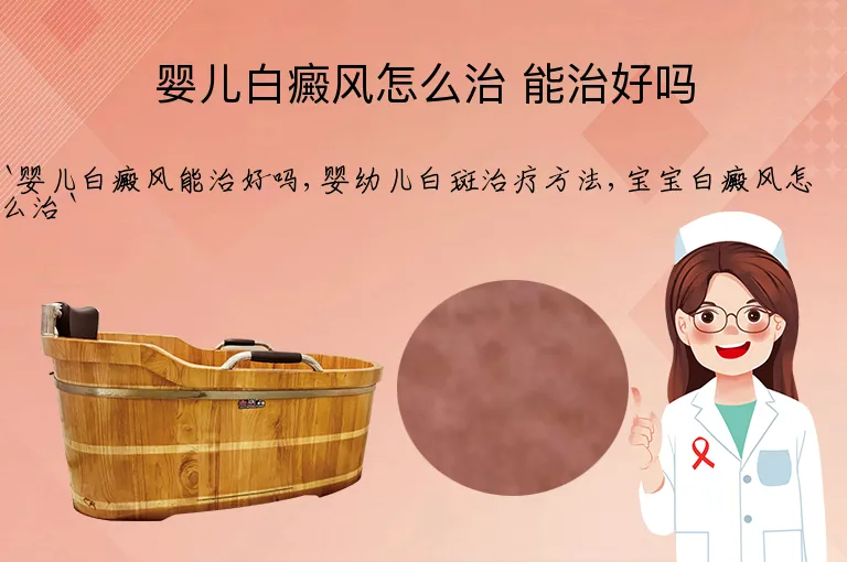 婴儿白癜风怎么治 能治好吗