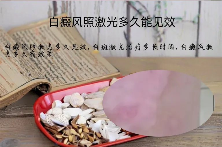 白癜风照激光多久能见效