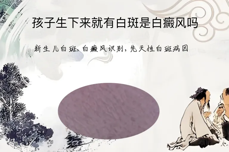 孩子生下来就有白斑是白癜风吗