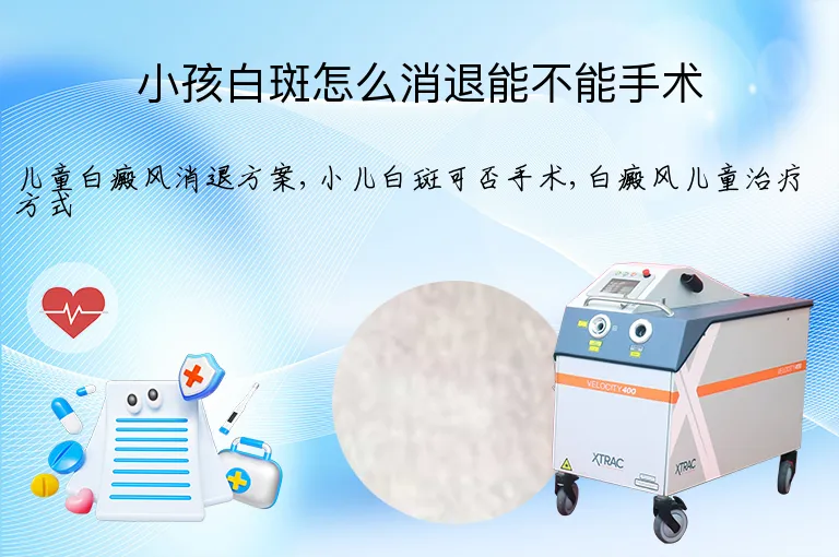 小孩白斑怎么消退能不能手术