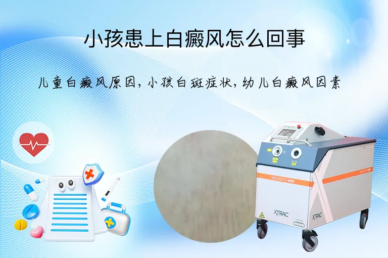 小孩患上白癜风怎么回事