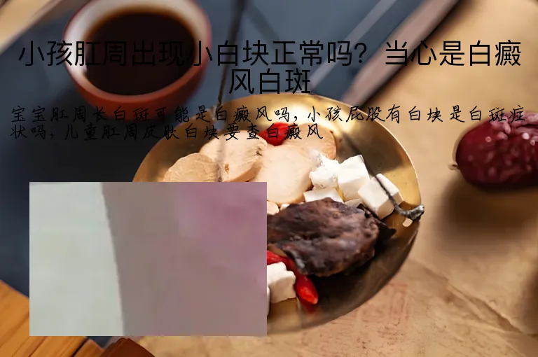 小孩肛周出现小白块正常吗？当心是白癜风白斑