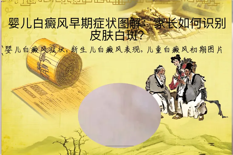 婴儿白癜风早期症状图解：家长如何识别皮肤白斑？
