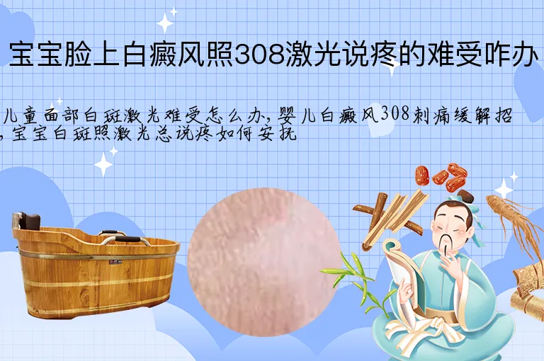宝宝脸上白癜风照308激光说疼的难受咋办