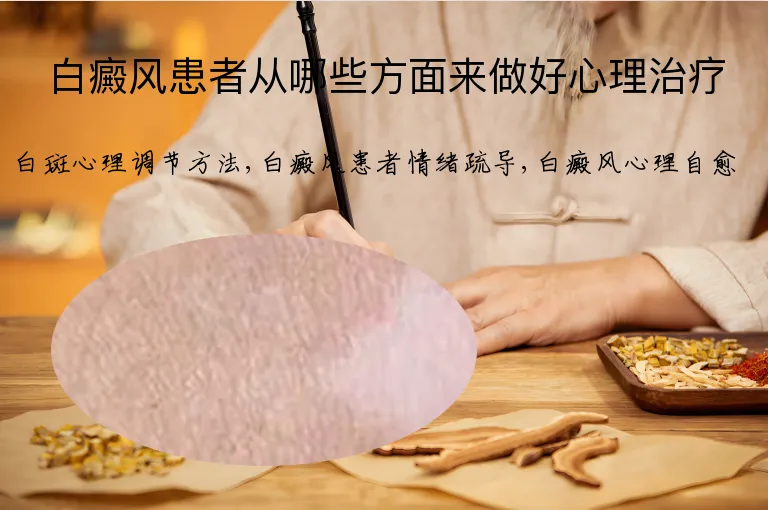 白癜风患者从哪些方面来做好心理治疗
