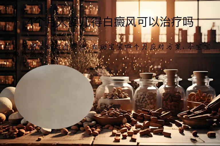 4个月大婴儿得白癜风可以治疗吗