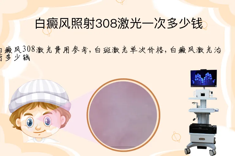 白癜风照射308激光一次多少钱