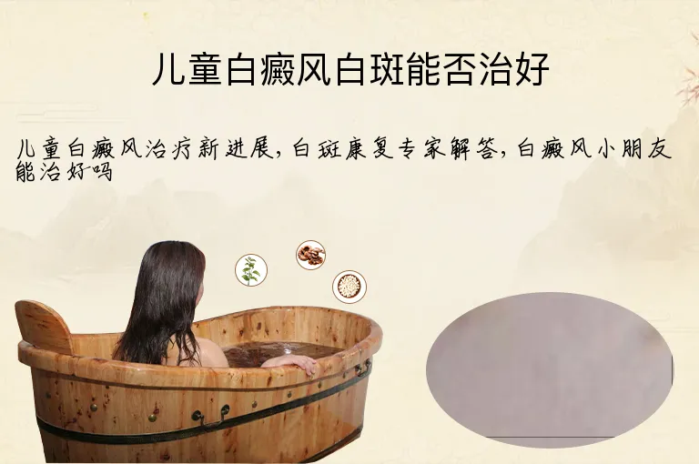 儿童白癜风白斑能否治好