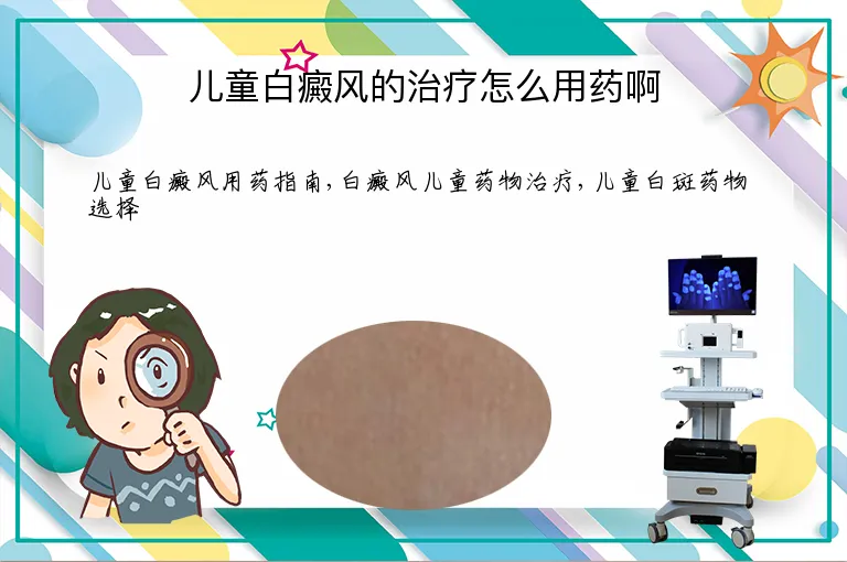 儿童白癜风的治疗怎么用药啊