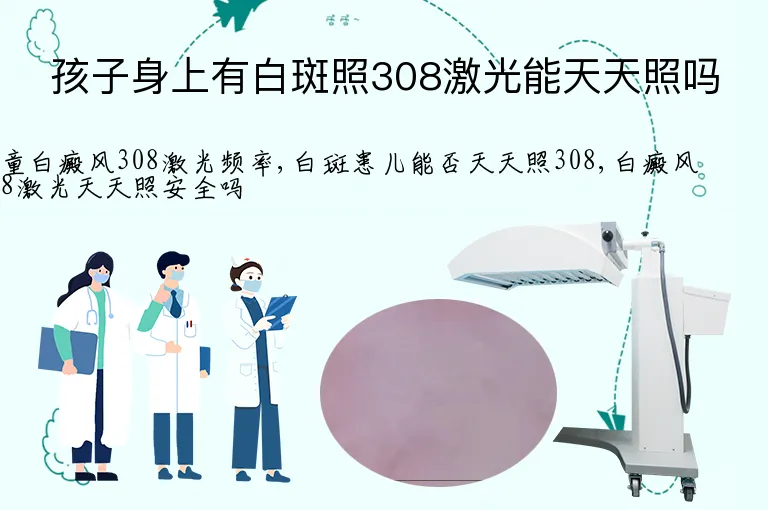 孩子身上有白斑照308激光能天天照吗