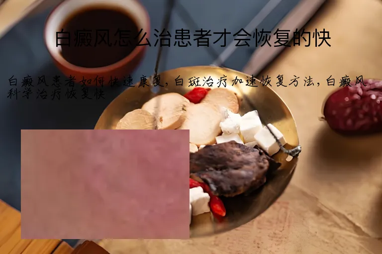 白癜风怎么治患者才会恢复的快