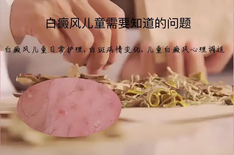 白癜风儿童需要知道的问题
