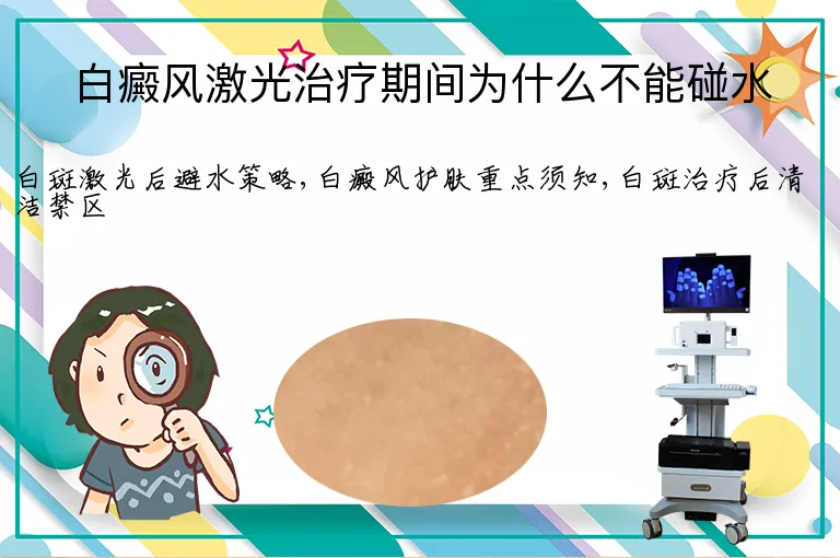 白癜风激光治疗期间为什么不能碰水