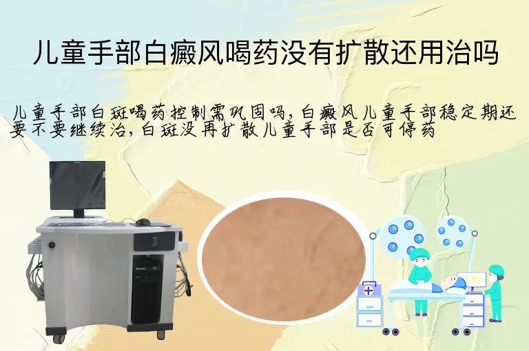 儿童手部白癜风喝药没有扩散还用治吗