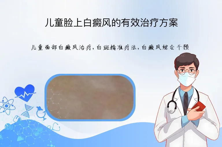 儿童脸上白癜风的有效治疗方案