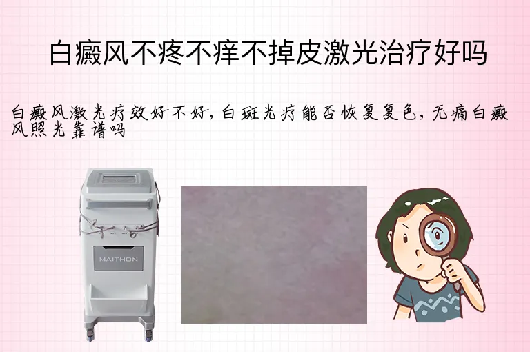 白癜风不疼不痒不掉皮激光治疗好吗