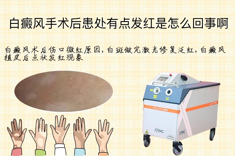 白癜风手术后患处有点发红是怎么回事啊