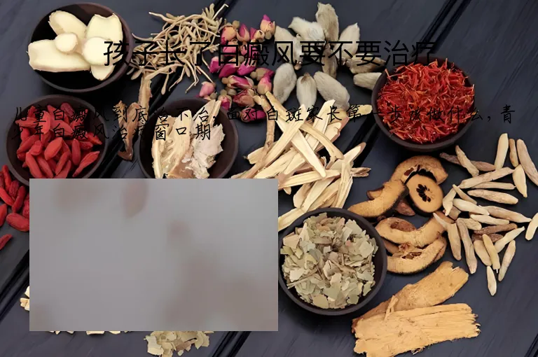 孩子长了白癜风要不要治疗