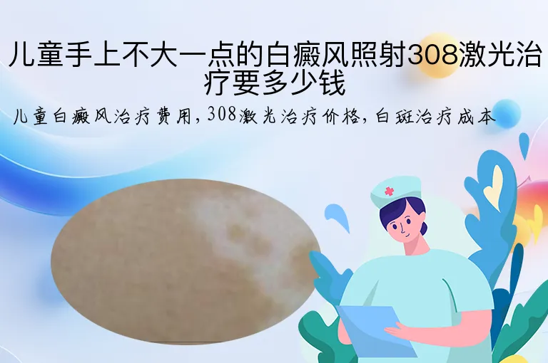 儿童手上不大一点的白癜风照射308激光治疗要多少钱
