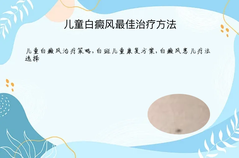 儿童白癜风最佳治疗方法