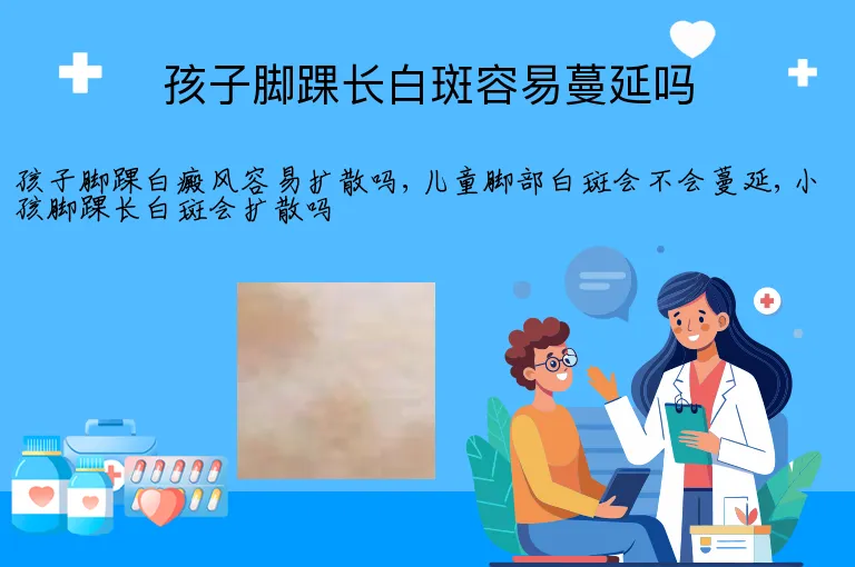 孩子脚踝长白斑容易蔓延吗