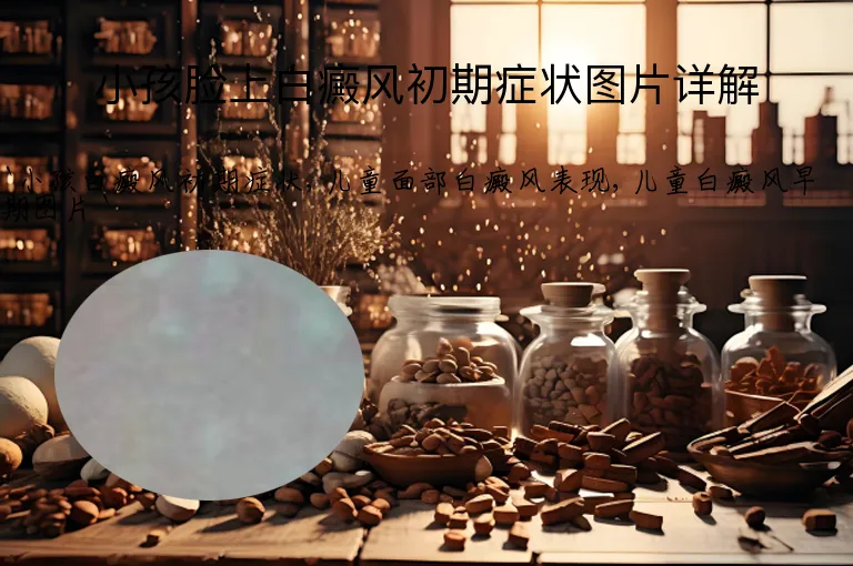 小孩脸上白癜风初期症状图片详解