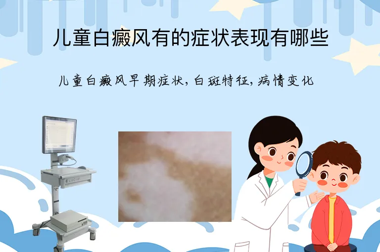 儿童白癜风有的症状表现有哪些
