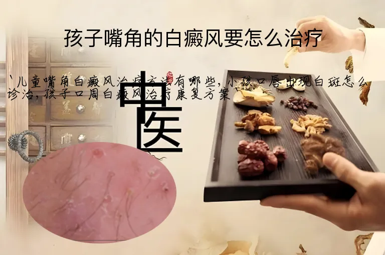 孩子嘴角的白癜风要怎么治疗