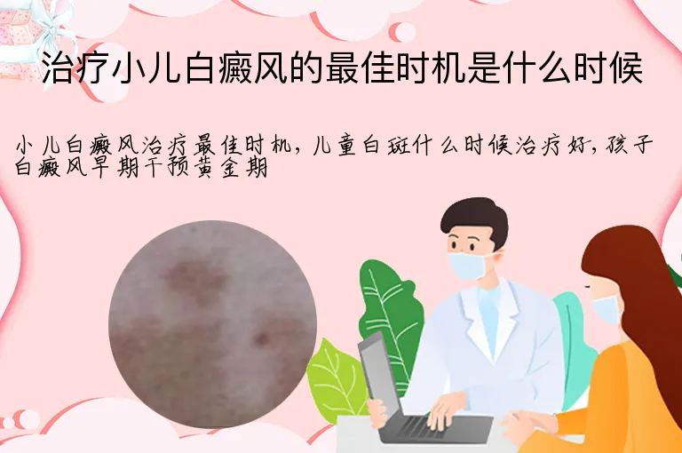 治疗小儿白癜风的最佳时机是什么时候