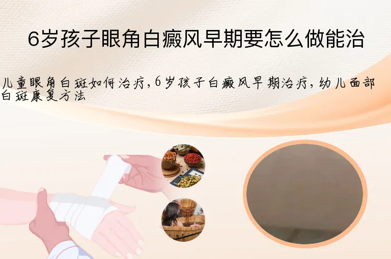 6岁孩子眼角白癜风早期要怎么做能治
