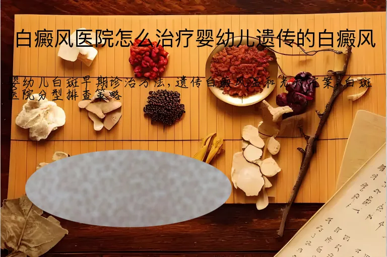 白癜风医院怎么治疗婴幼儿遗传的白癜风