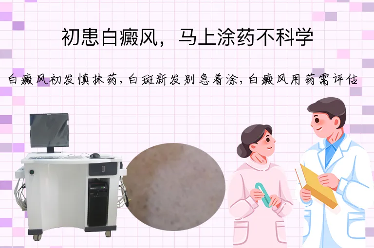 初患白癜风，马上涂药不科学