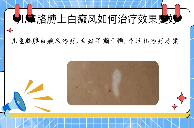 儿童胳膊上白癜风如何治疗效果更好