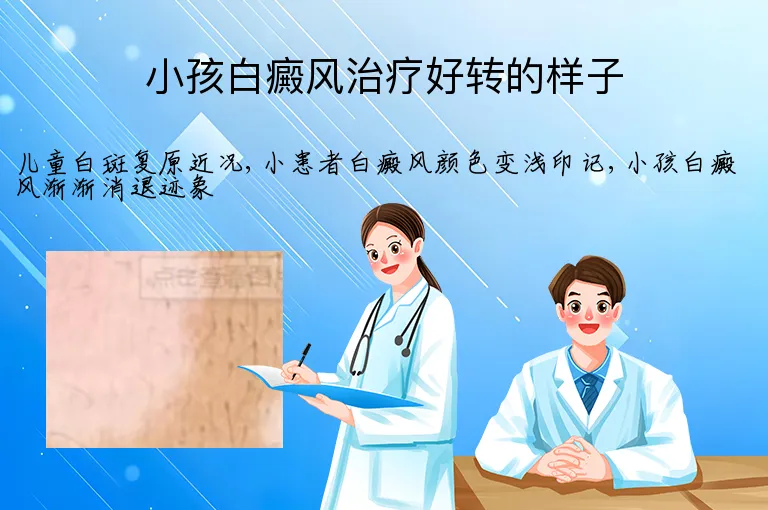 小孩白癜风治疗好转的样子